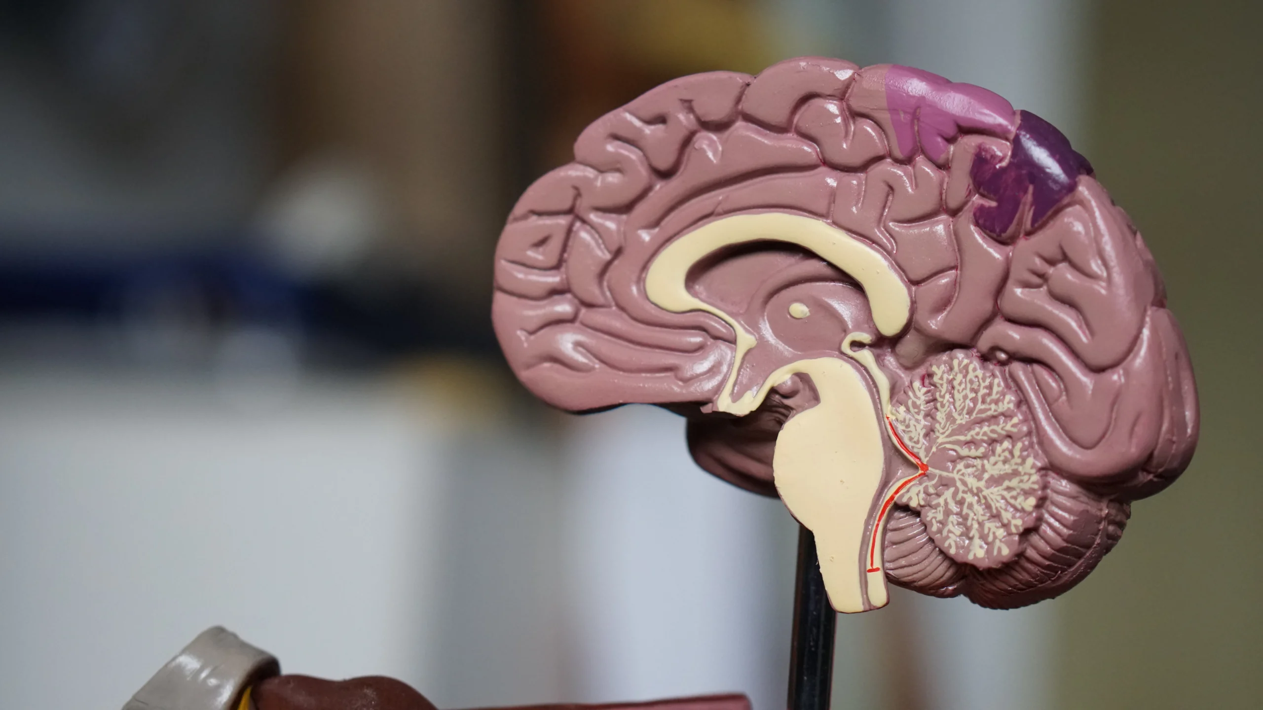 A model of a brain cut in half to represent neurodiversity and neurodivergence in the workplace.